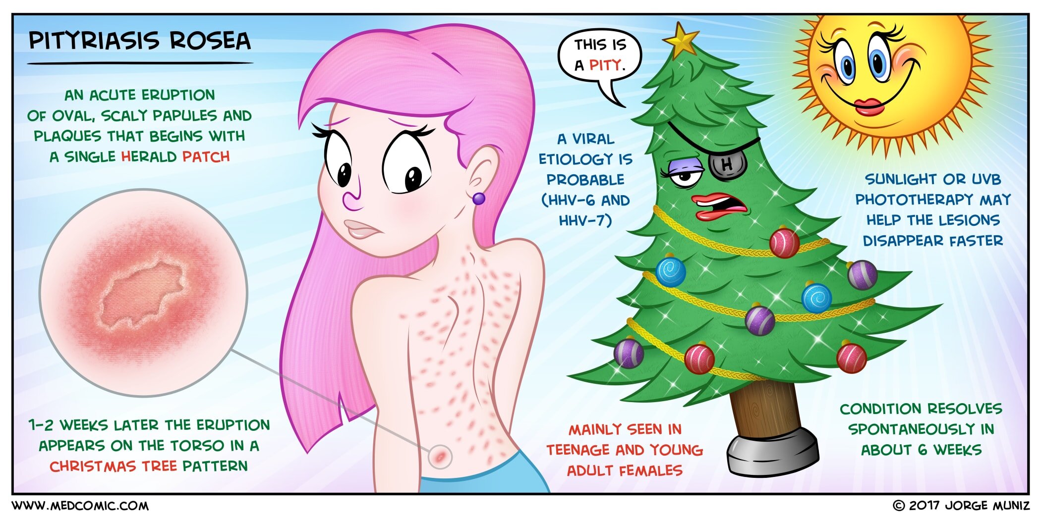 Educational medical illustration of pityriasis rosea showing the herald patch (erythematous oval plaque with collarette of scale), the subsequent Christmas tree pattern distribution on the trunk following skin cleavage lines, and association with human herpesvirus HHV-6 and HHV-7