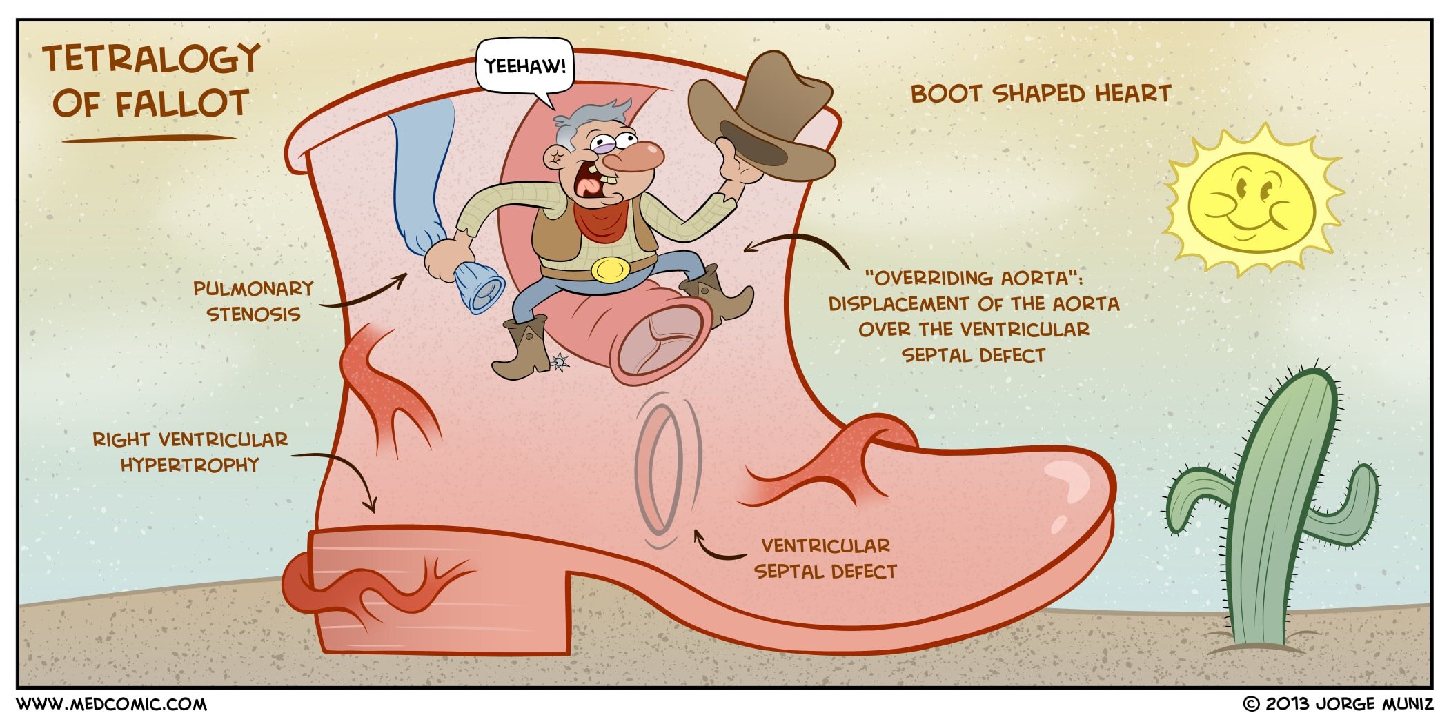 Educational medical illustration of Tetralogy of Fallot (TOF), the most common cyanotic congenital heart defect, showing the four components using the PROV mnemonic: Pulmonary stenosis, Right ventricular hypertrophy, Overriding aorta, and Ventricular septal defect, with boot-shaped heart on chest radiograph and hypoxemic Tet spells