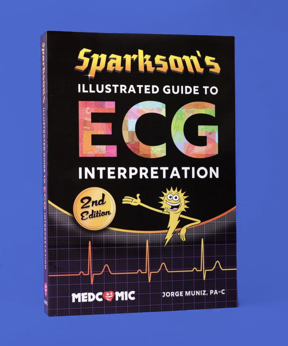 Sparkson's Illustrated Guide to ECG Interpretation